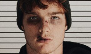 Image shows a close-up of a young man with two black eyes, a cut lip, and a cut on the bridge of his nose. He looks like he was recently in a boxing match or other such fight. He is wearing a black knit cap.