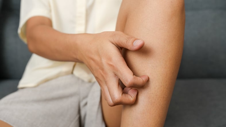 What Causes Itching That Moves Around the Body?